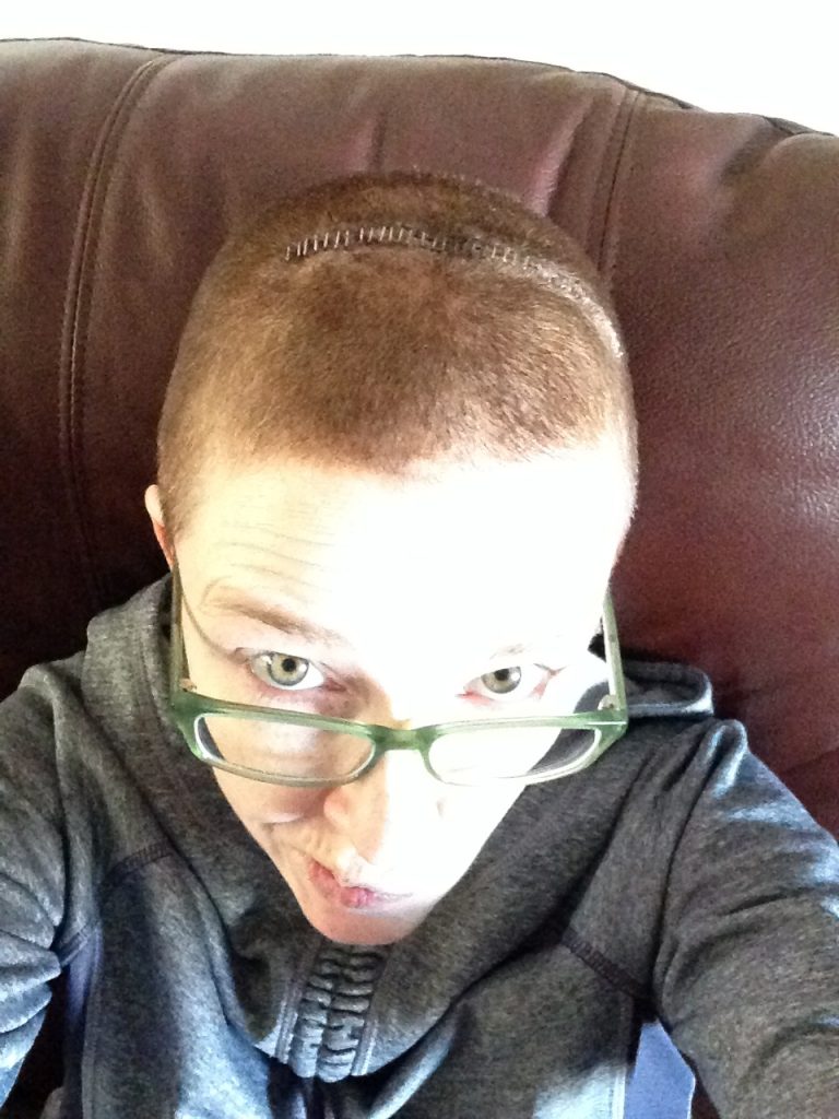 Trying to take a selfie with my staples before they came out.